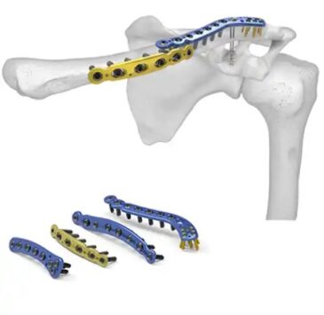 Orthopedic-Implants-Instruments